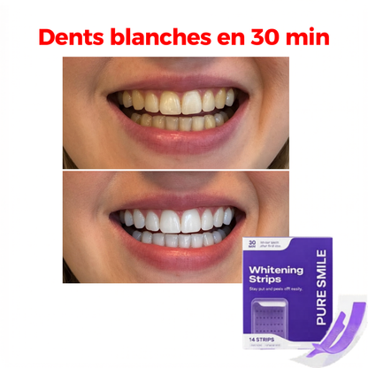 Bande de blanchiment dentaire V2